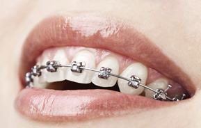 Orthodontics