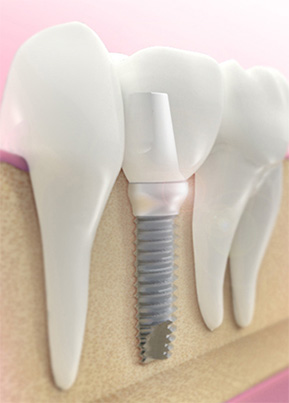 Cosmetic Dentistry