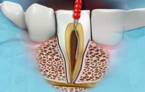 Endodontics